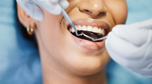 Best Emergency Treatment for Dental Infections or Abscesses in Landover Hills, MD